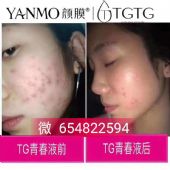 TGTG��ʲôƷ�ƣ���Ĥ��ƷTGTG�ഺҺЧ����ô���������
