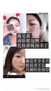 ɫ棬ͷöûЧأ