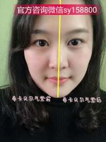 ϣ��������������˪Ч������𣿾����̴����۸��