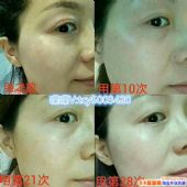 ��ϣ��������Ĥ�������ż��Ƕ��٣���������۸��ͼ��