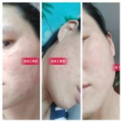 ������ľ����ˮ���������Ĺ�Ч��ʲô�����������ܵ�������