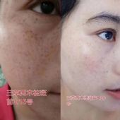 ������ľ��������˪�����ʹ�ã�