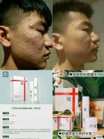 ������ľ��ȥ�����������м�����ʹ����