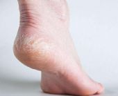 ������ź�����ѳ�Ѫ�Ŀ������Ʒ���