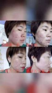 ����ʯ���ഺ����Һ